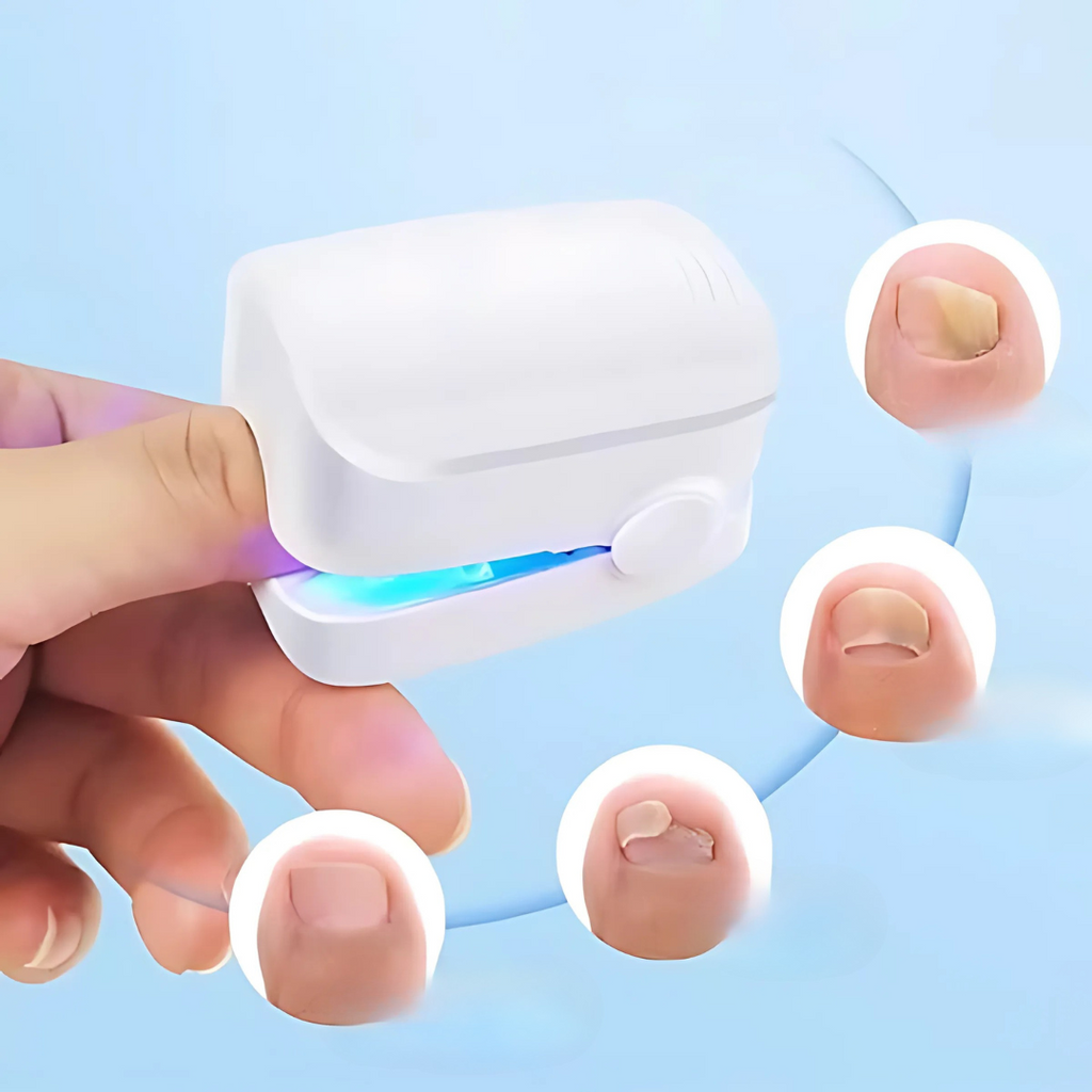 Nail Treatment Laser Device for Fungal Care