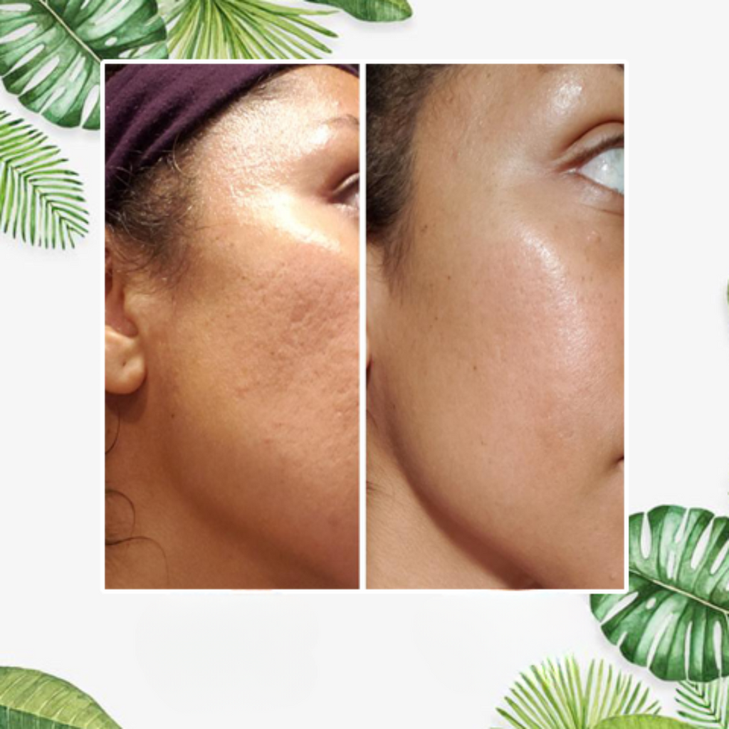 Face Mask Stick for Oily Skin Detox