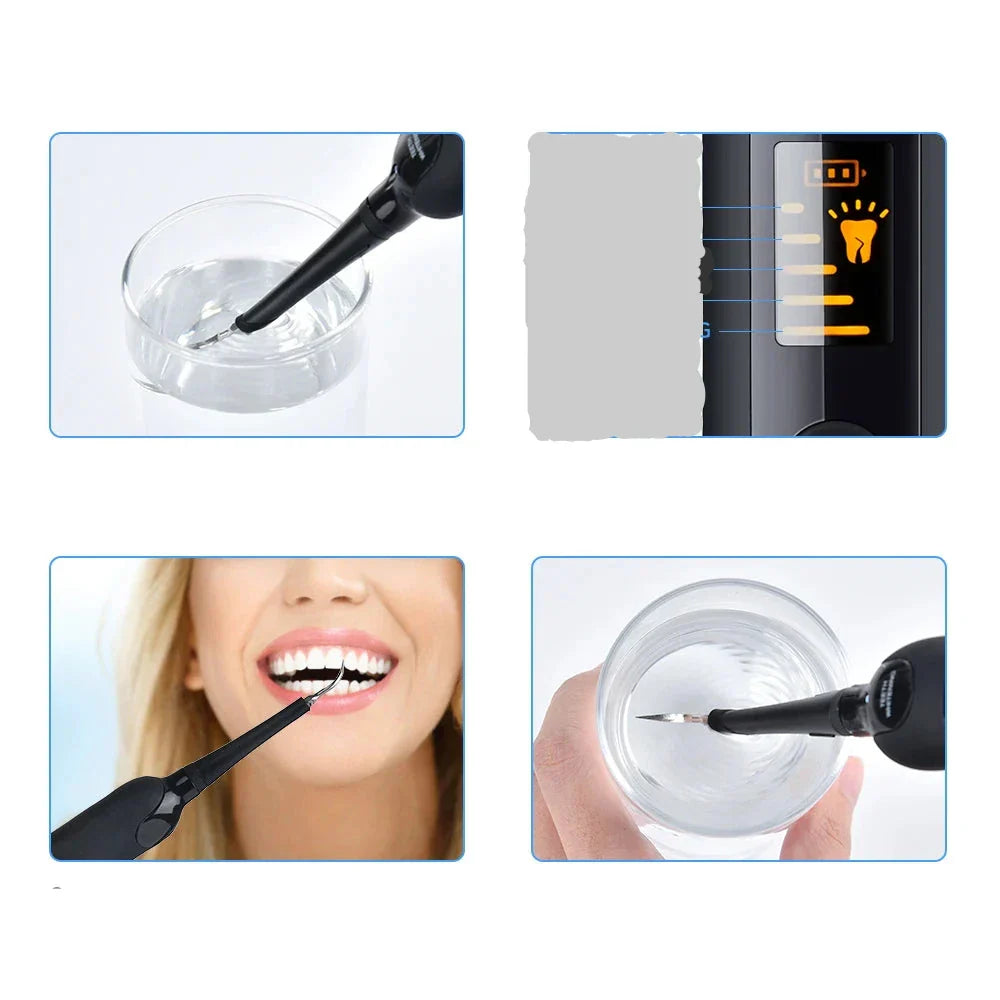 Teeth Cleaner | Waterproof Electric Scaler Tool for Home
