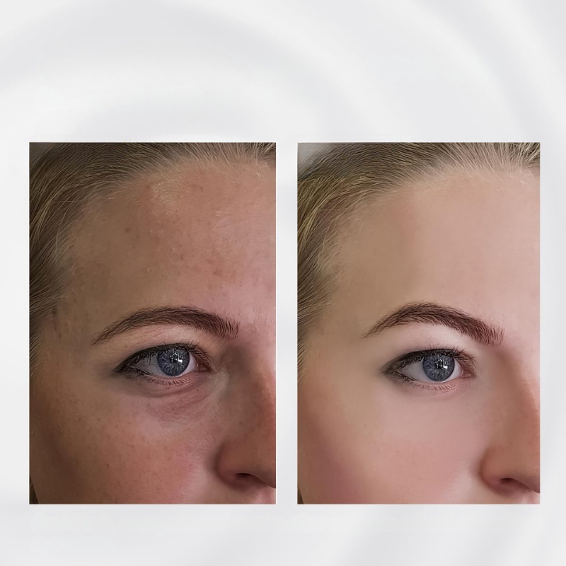 Facial Roller Stainless Steel Puffiness Massager