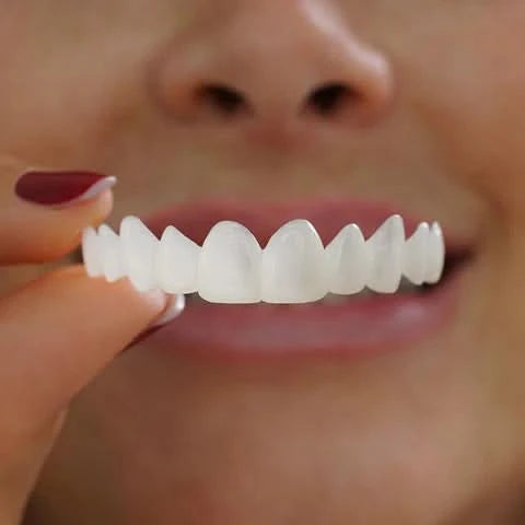 Veneers for Teeth with Natural White Finish