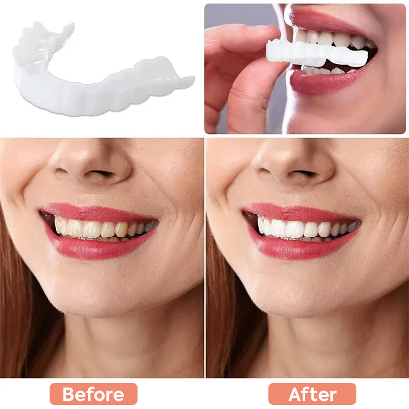 Veneers for Teeth with Natural White Finish